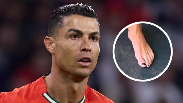 Chiến lược khôn ngoan! Lý do Ronaldo sơn móng chân màu đen_69412c27cfec1.jpeg